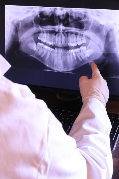 Best Emergency Dental Care for Broken or Chipped Teeth in Las Animas, CO