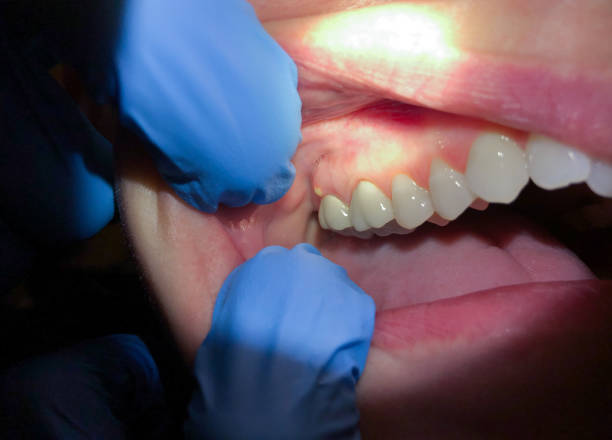 Best Cosmetic Emergency Dentistry in Las Animas, CO