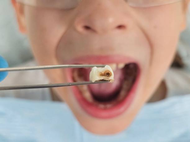 Best Pediatric Emergency Dentist in Las Animas, CO
